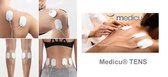 Medicu® - TENS apparaat VDP1