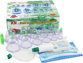 Chinese Cupping - 20 Delig - Massage - Cupping Set - Cupping Set Massage - Cups