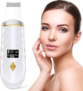 Shoplace Ultrasoon Huidverjongingsapparaat met Heating - Reiniging, Hydratatie & Versteviging - Verwijdert Mee-eters - Puisten verwijderaar - Verzacht rimpels - Anti-Acne – Skin scrubber