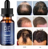 Regrowth | Haarserum - Alternatief Minoxidil 5% - Haargroei Producten