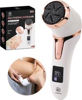 Beeperfect® Elektrische Eeltverwijderaar met Stofzuigsysteem - Voetvijl - Eeltvijl - IPX7 Waterdicht - Gratis pedicure set -